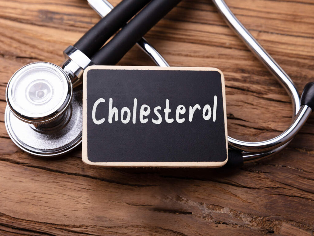 What are the symptoms and signs of High Cholesterol?