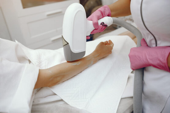 Laser Hair Removal